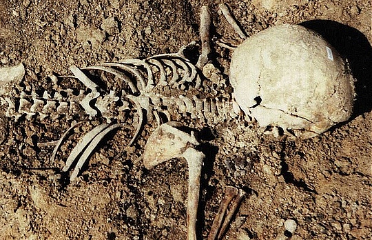 Skeleton_m94417Les na Sumshhine usejan ostankami evreev, rasstreljannyh vo vremja VOV